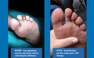 ageless-wellness-toes