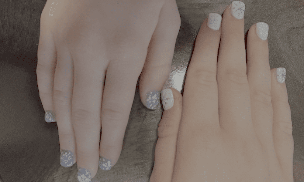 A Christmas Tree Scar