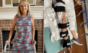 Break a Leg